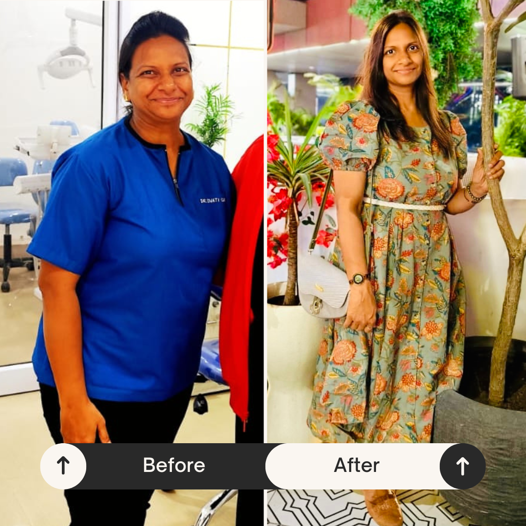 Client before and after — weight management