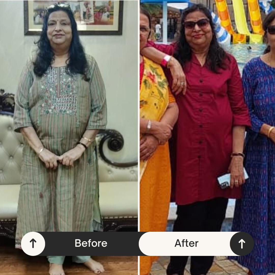 Client before and after — weight management